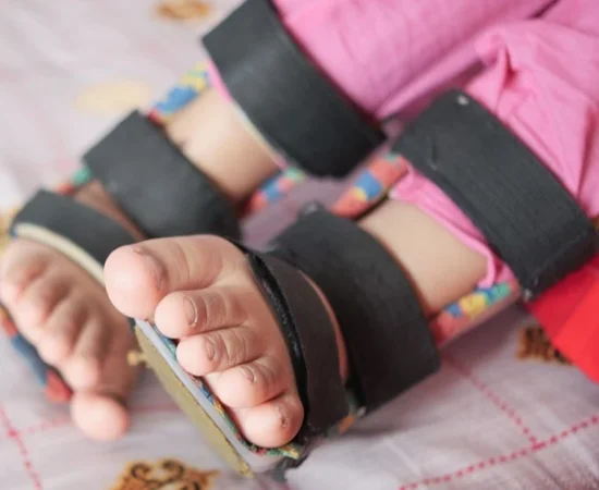 Orthotic Devices Guidance